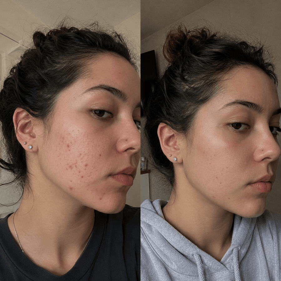 Lauren F, 26